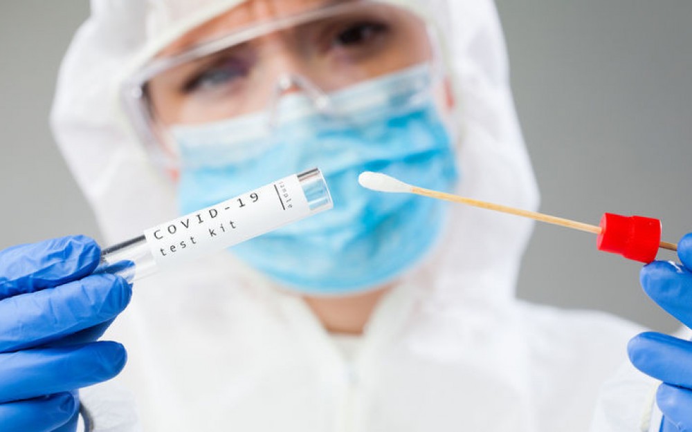 Svjetska javnost pet godina nema neke ključne odgovore u vezi sa korona virusom Svjetska javnost pet godina nema neke ključne odgovore u vezi sa korona virusom