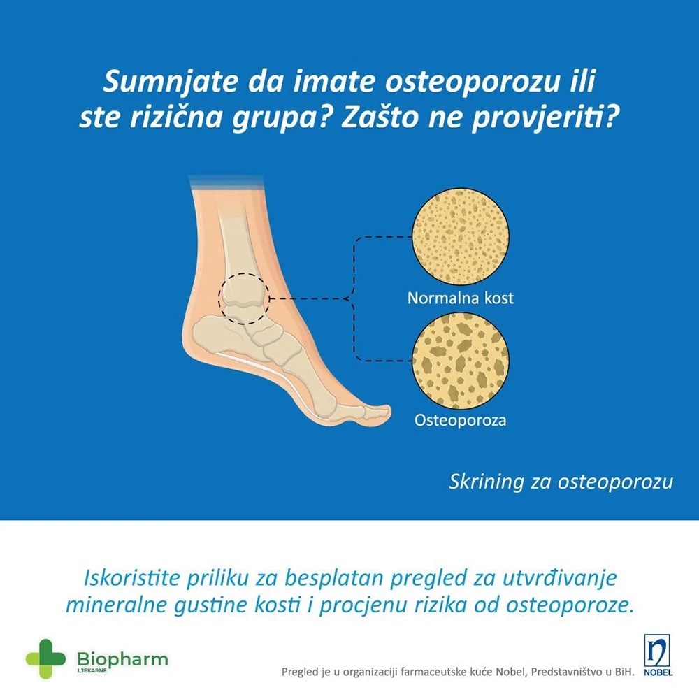 Sumnjate na osteoporozu? Dođite na besplatan pregled u ljekarnama Biopharm Sumnjate na osteoporozu? Dođite na besplatan pregled u ljekarnama Biopharm
